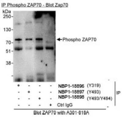 Immunoprecipitation: ZAP70 [p Tyr319] Antibody [NBP1-18896]